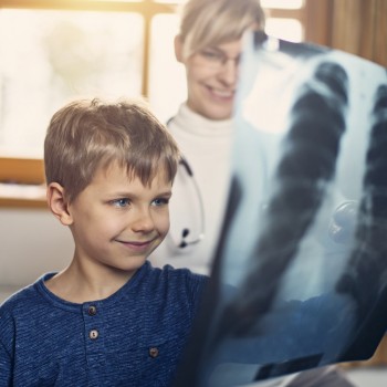 Los riesgos de las radiografías en niños que preocupan a los padres