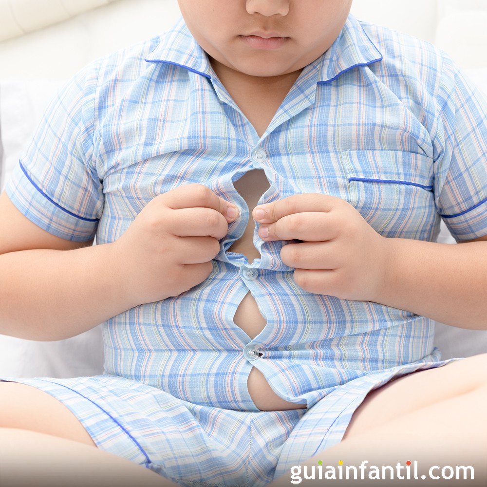 Consecuencias de la obesidad infantil - Qué riesgos tiene para los niños