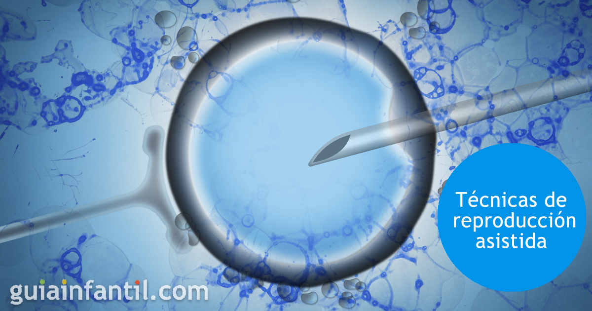 Técnicas de reproducción asistida