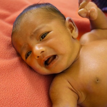 ¿Por qué mi bebé tiene la piel amarilla? Ictericia del recién nacido
