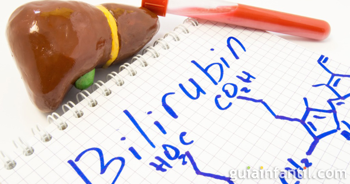 conocer si mi hijo tiene ictericia neonatal