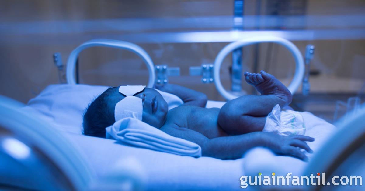 procedimientos para tratar la ictericia neonatal y disminuir el color de la piel amarilla