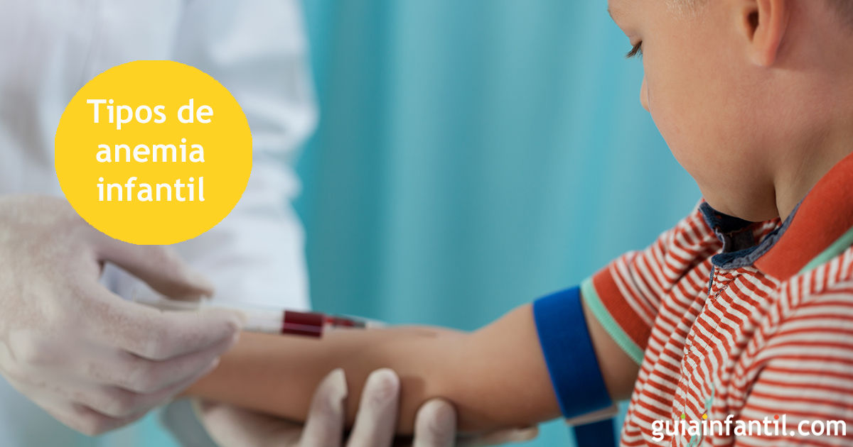 Tipos de anemia infantil según sus causas