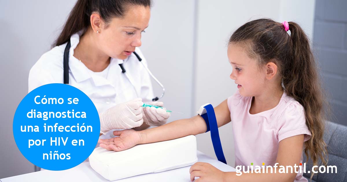 diagnostico del HIV