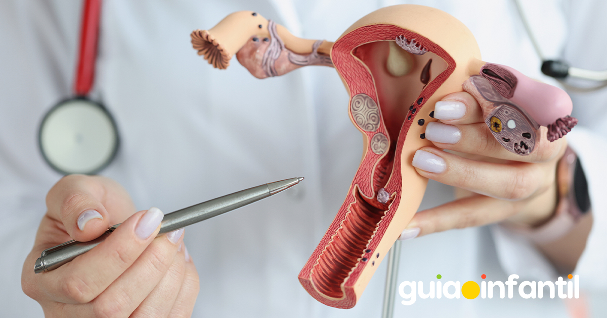 La reserva ovárica baja en la mujer