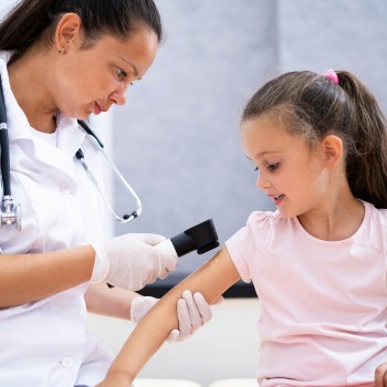 El cáncer de piel en niños - Guía para padres sobre cáncer infantil