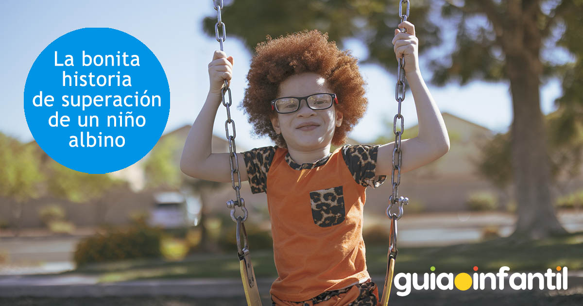 la historia de fortaleza de un niño albino