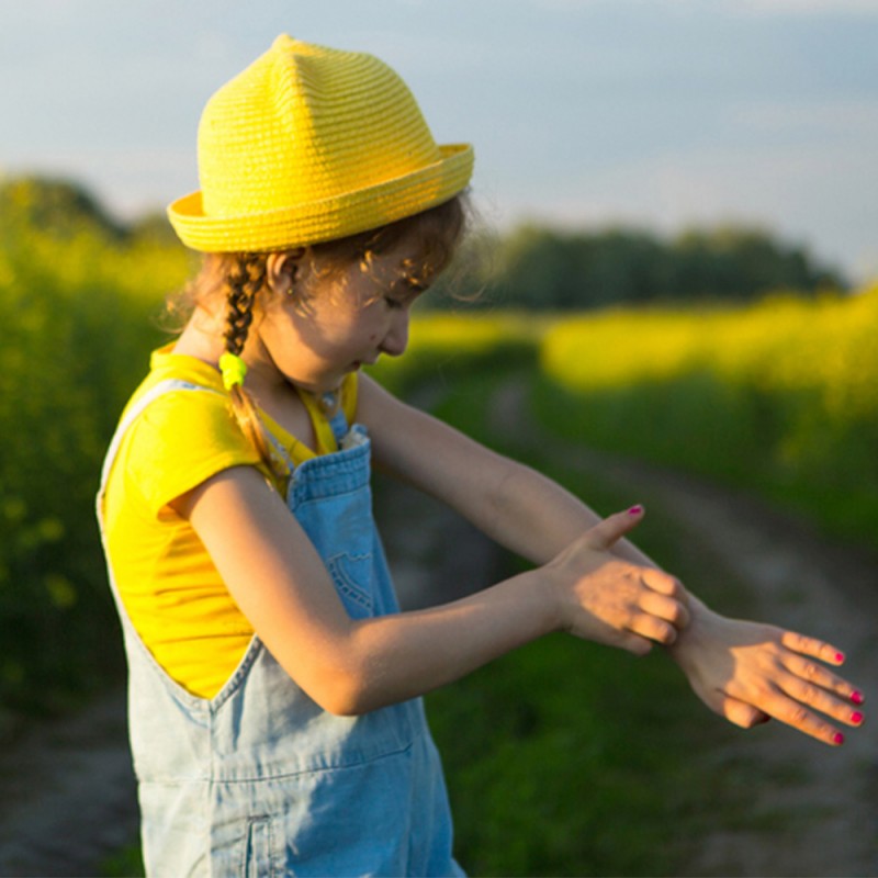 Picaduras de insectos en niños - Cómo diferenciarlas y aliviar el picor