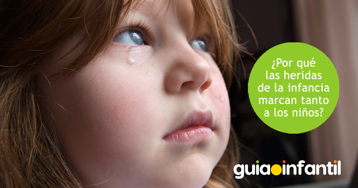 Las heridas de los niños los marcan mucho