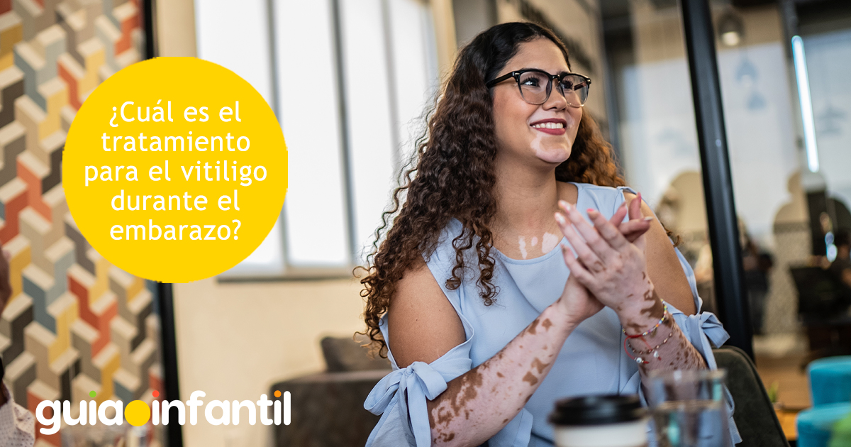 Tratamiento para el vitiligo