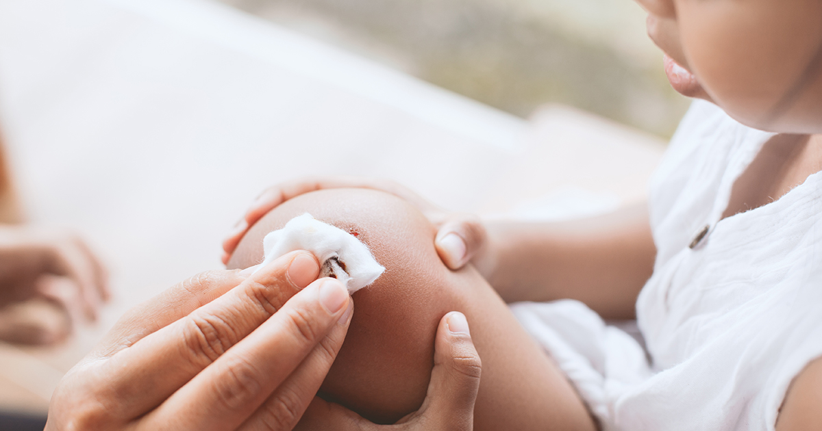 Antisépticos para desinfectar las heridas