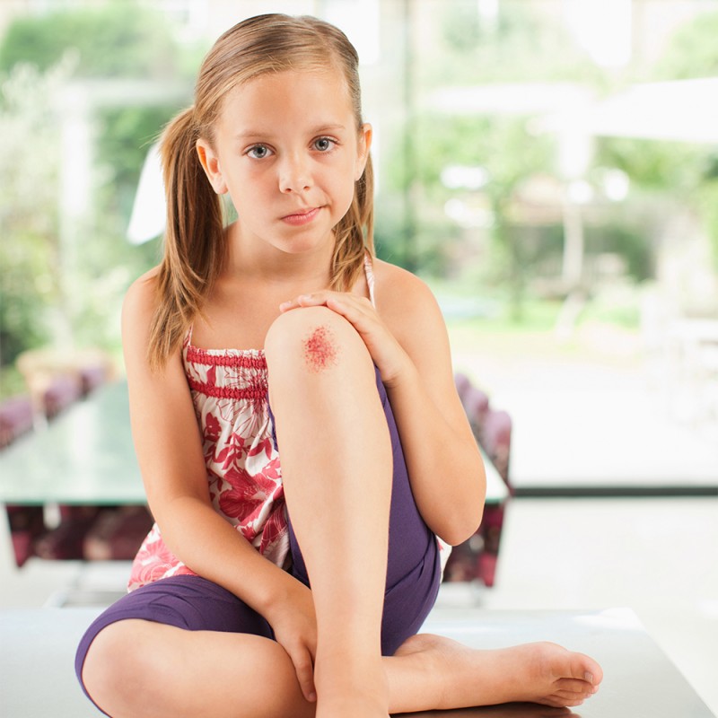 Primeros auxilios para heridas, golpes y chichones de los niños