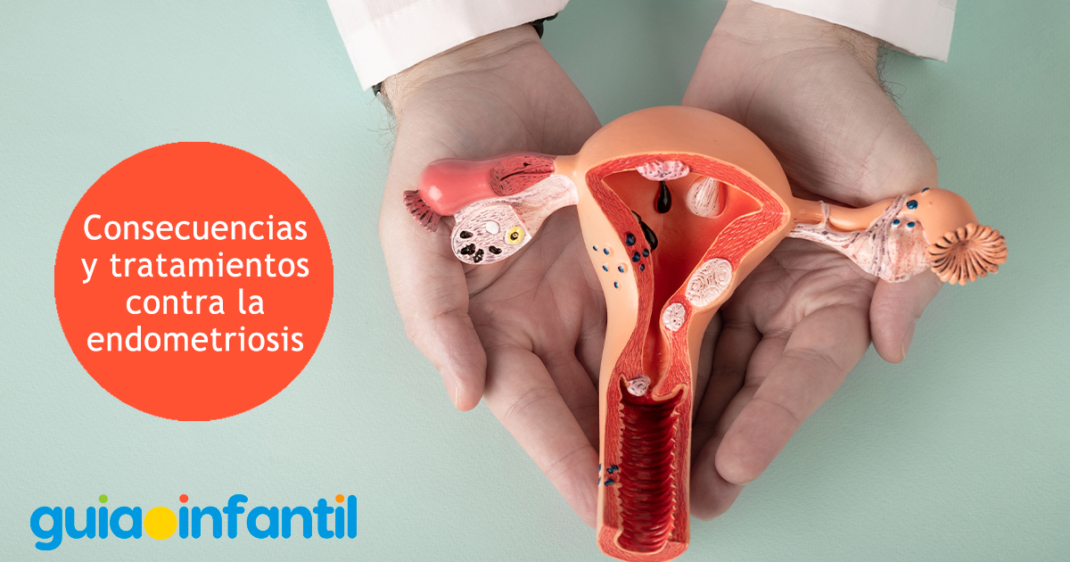 Tratamiento contra la endometriosis