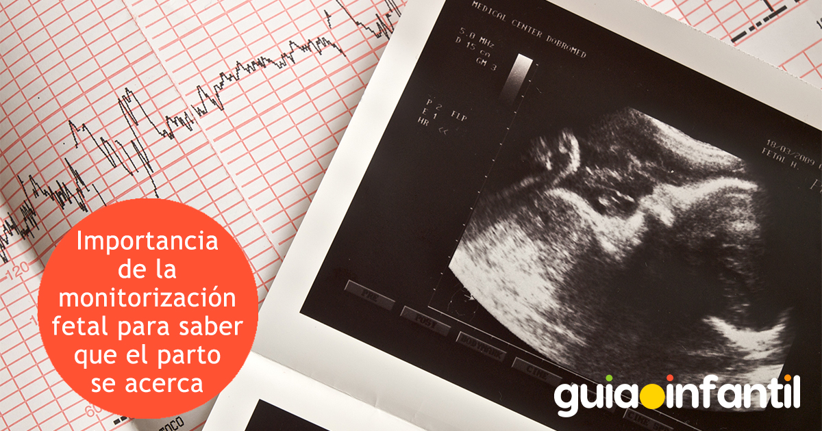 Importancia del monitoreo fetal