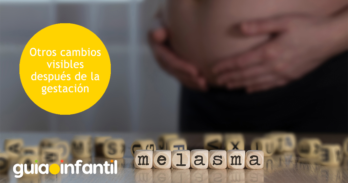 Cambios visibles de la gestación