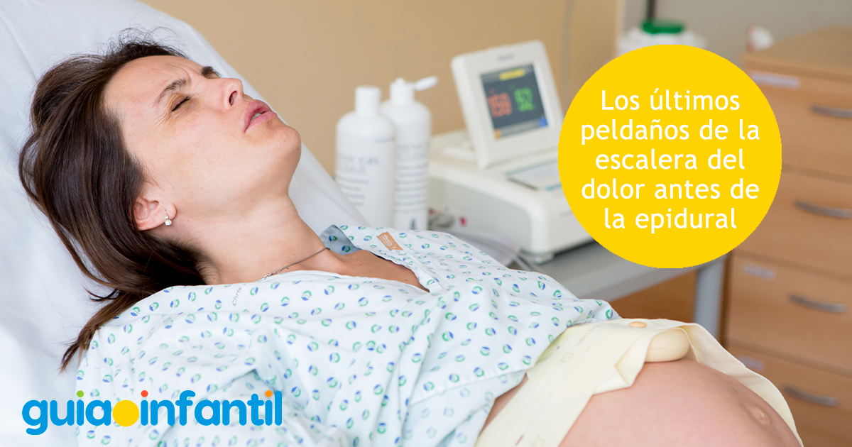 La epidural en la escalera del dolor