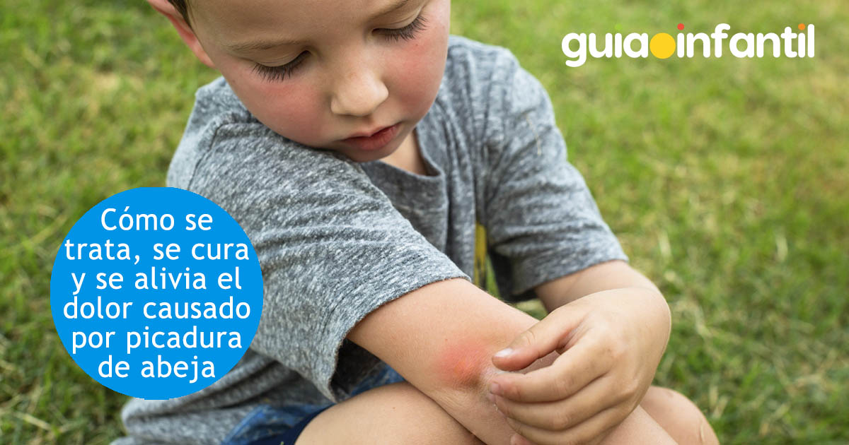 cura de picadura de abeja