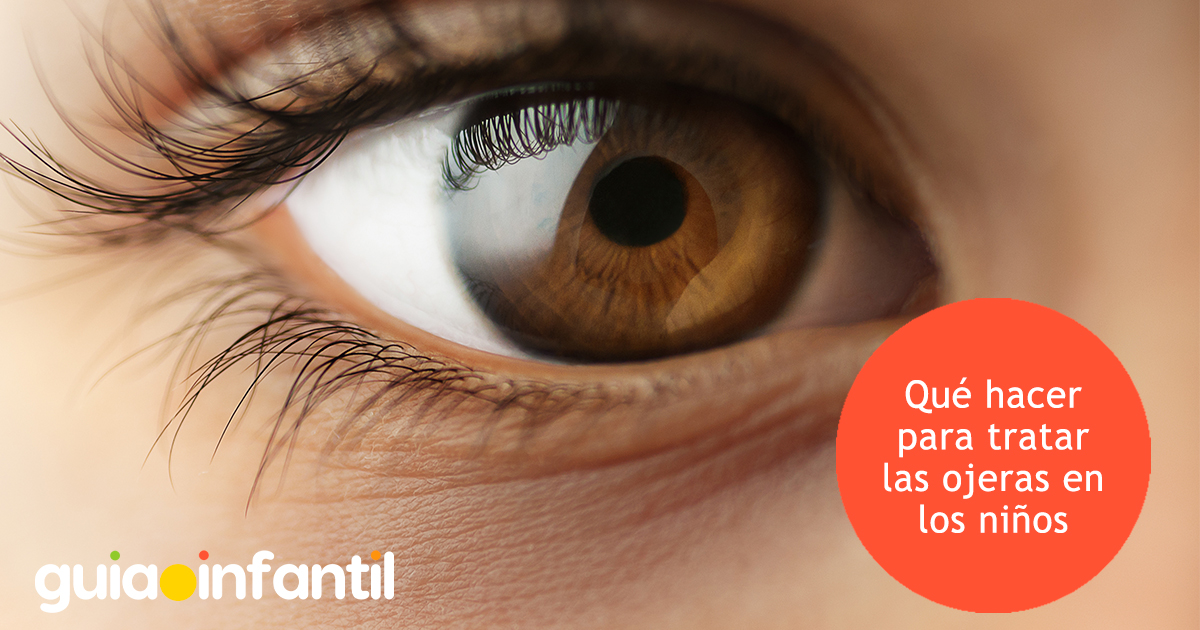 Tratamiento para las ojeras de los niños