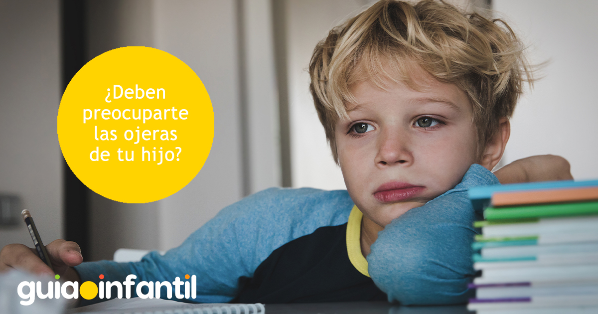 Por qué los niños tienen ojeras