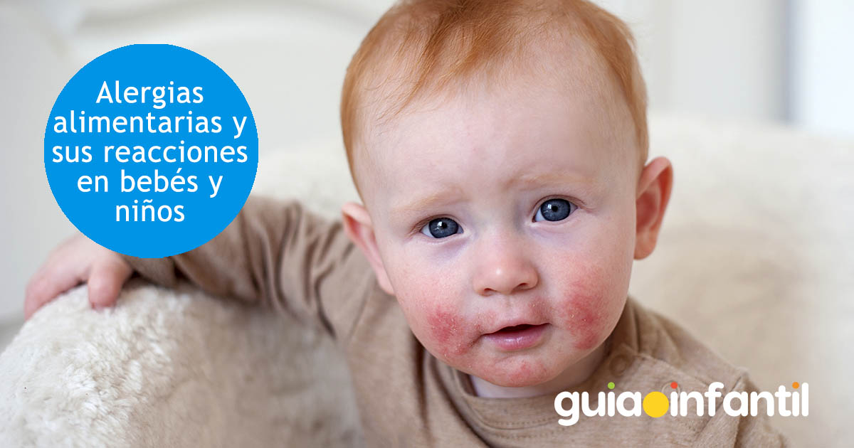 reacciones alergicas en bebés