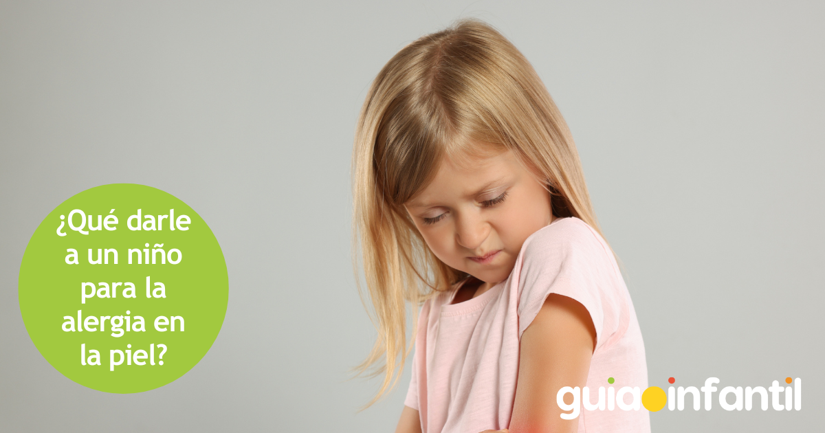 Qué sirve para la alergia en la piel de los niños