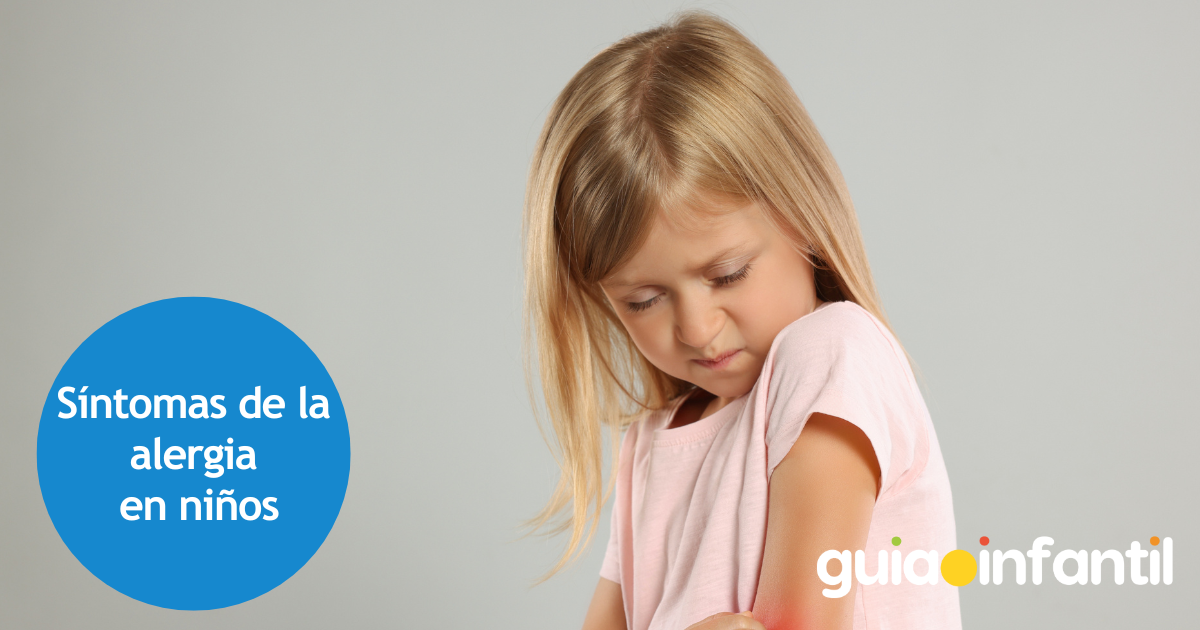 Síntomas de la alergia en niños