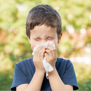 Alergia. Niños alérgicos