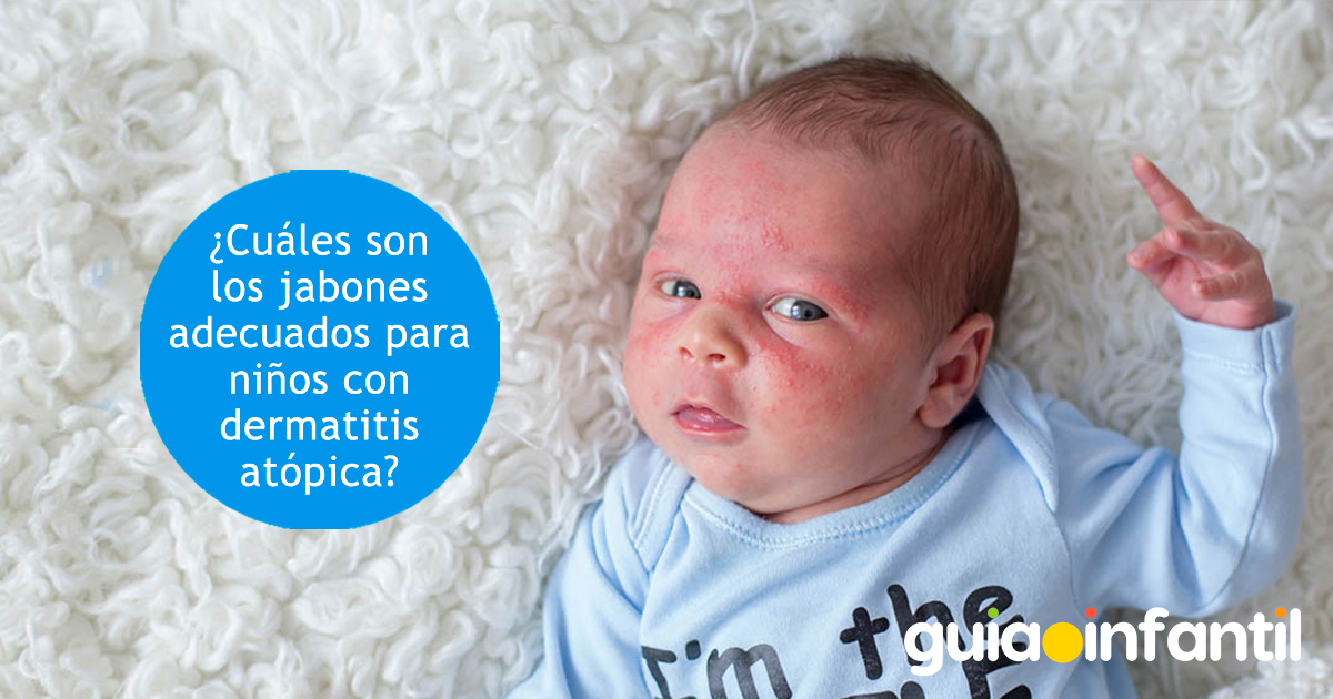 Jabones para niños con dermatitis atópica