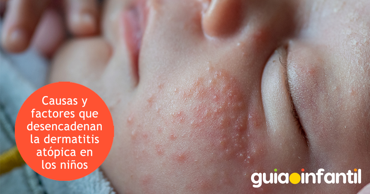 Factores de dermatitis en niños