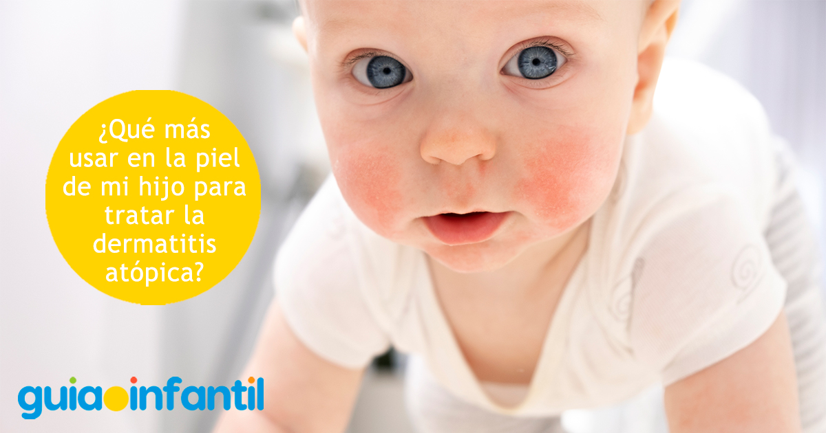 ¿Qué más usar en la piel con dermatitis?