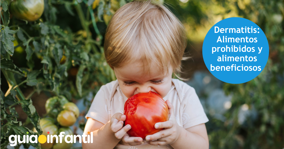 Dermatitis en niños: alimentos prohibidos y alimentos beneficiosos