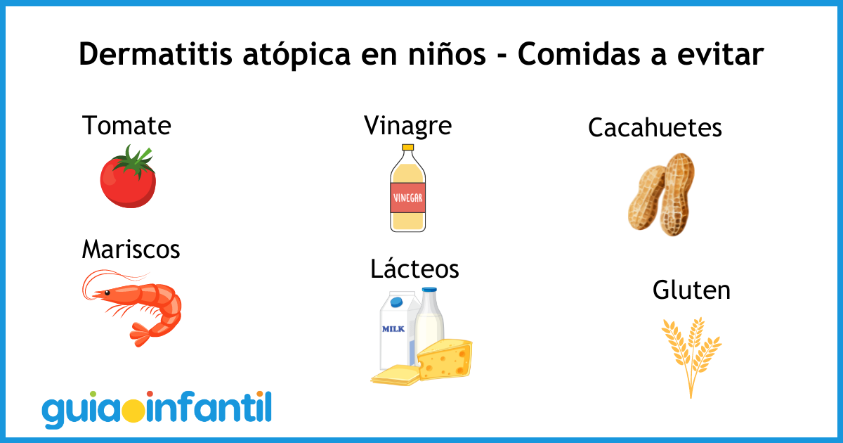 Comidas a evitar para niños con dermatitis atópica