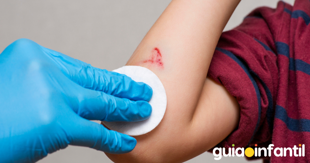 Infección por mordedura o arañazo de un gato