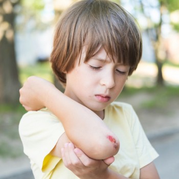 Guía completa de primeros auxilios para niños: Cómo actuar en emergencias