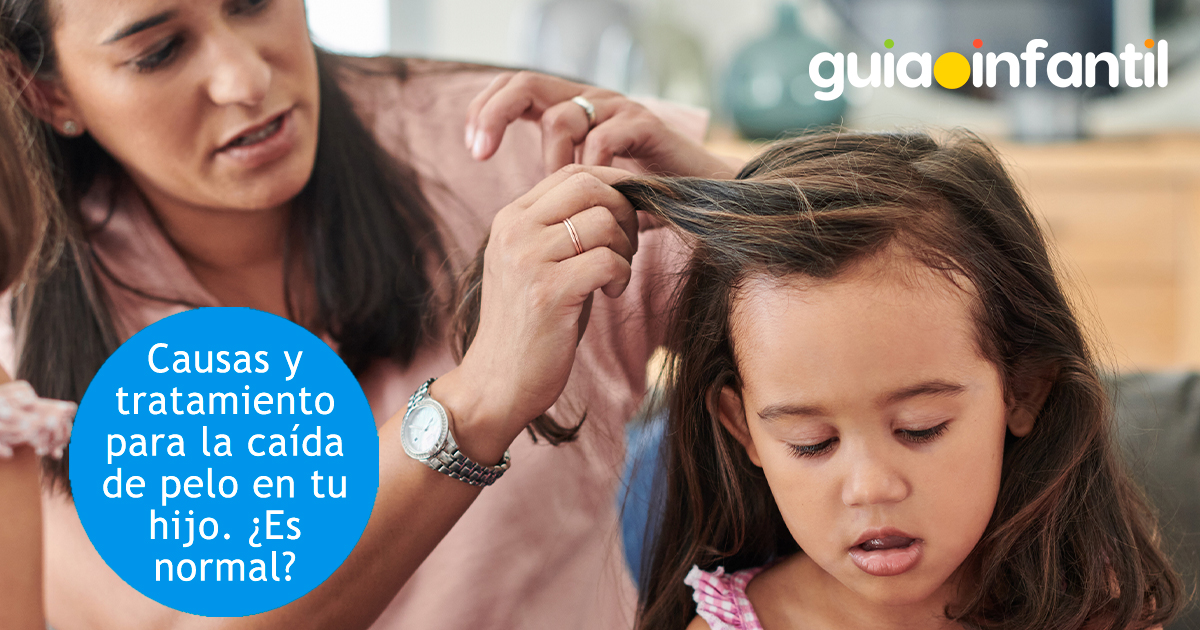 La caída de pelo en los niños