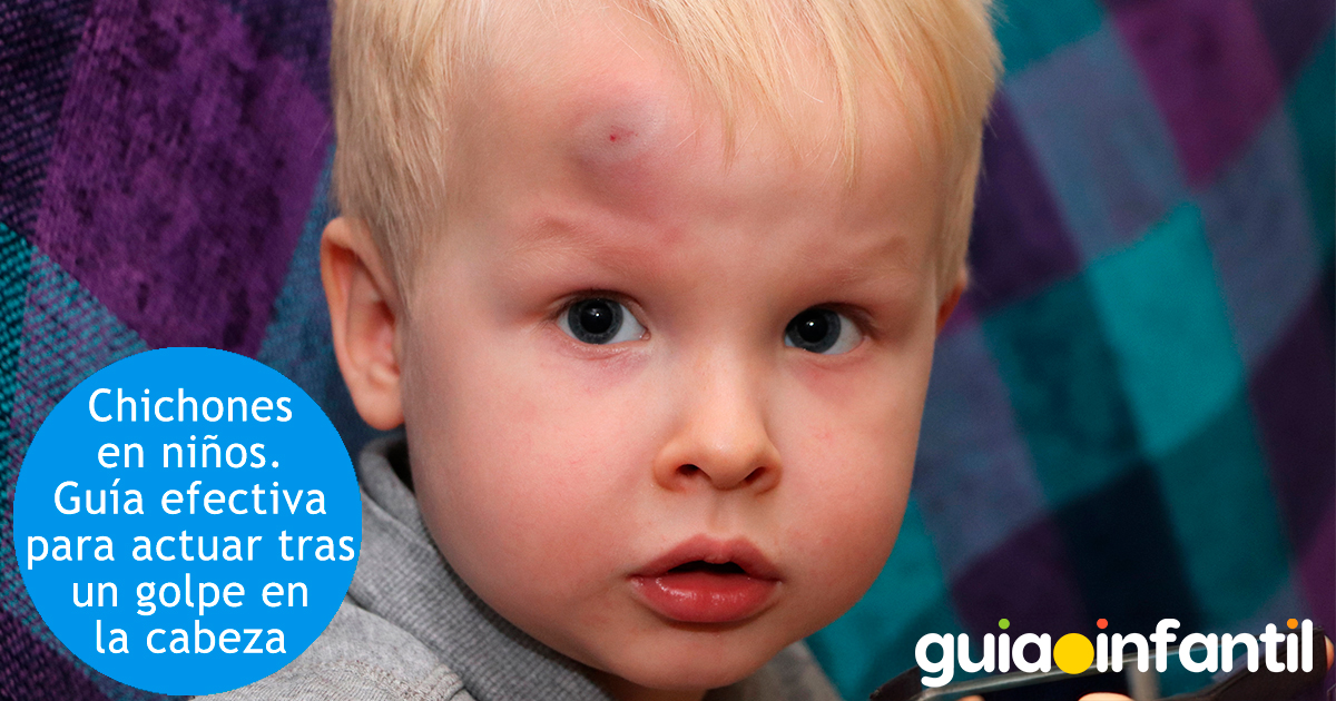Qué hacer ante los golpes en la cabeza de los niños