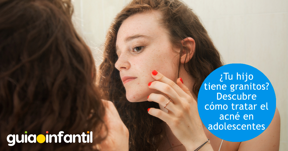 Granitos en adolescentes