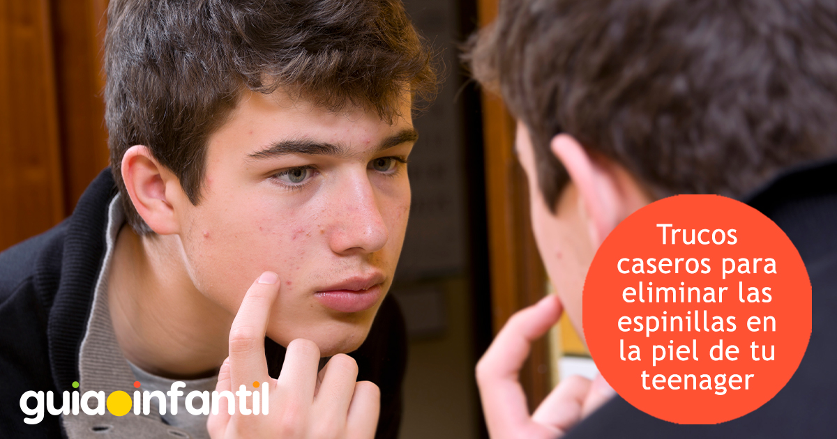 Trucos caseros contra el acné adolescente