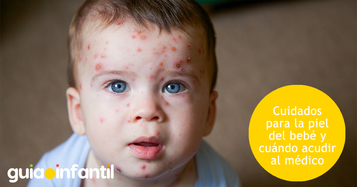 Cuidados para la piel del bebé