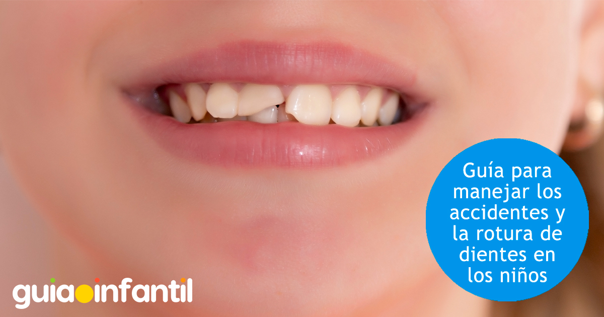 Rotura en los dientes de los niños