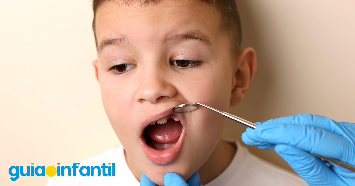 Dientes rotos en los niños