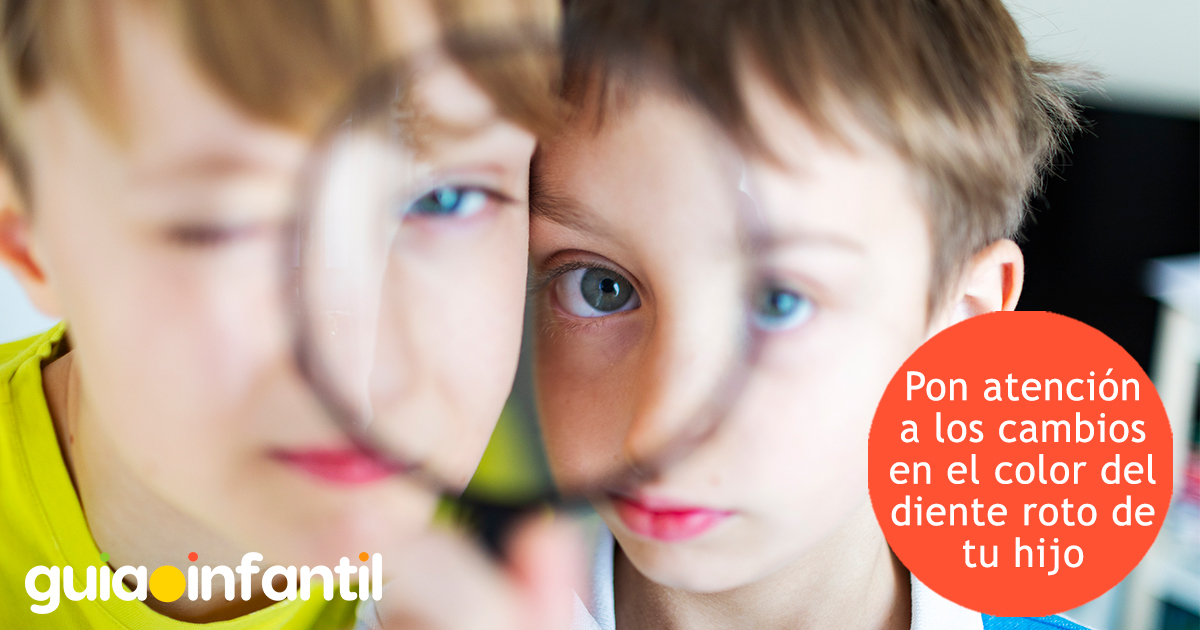 Cambios en el color del diente de los niños