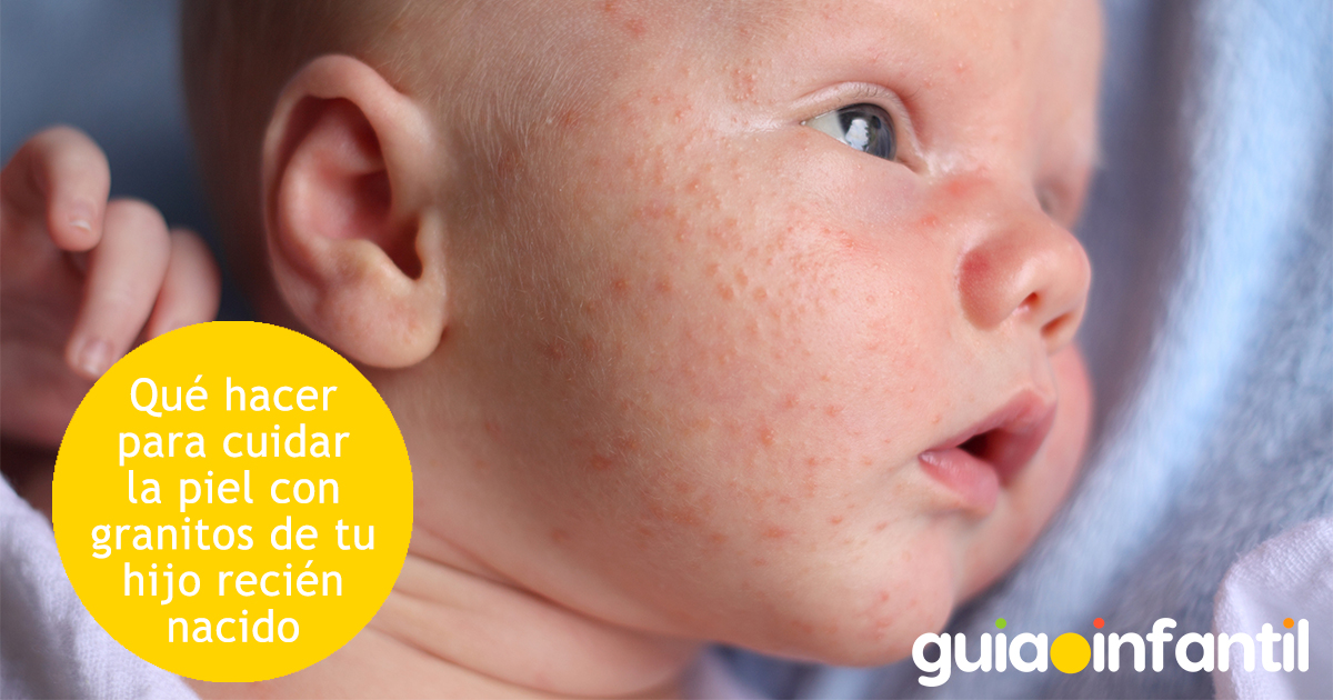 Granitos en la piel del bebé