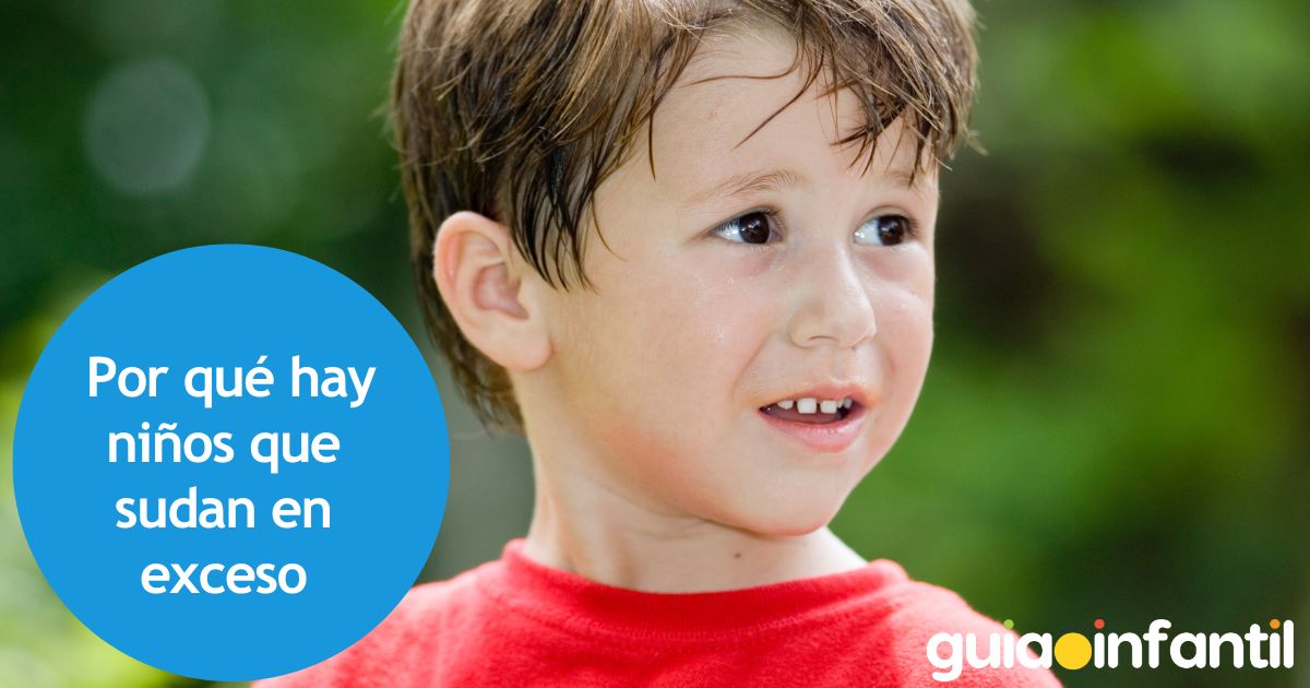 niños que sudan mucho