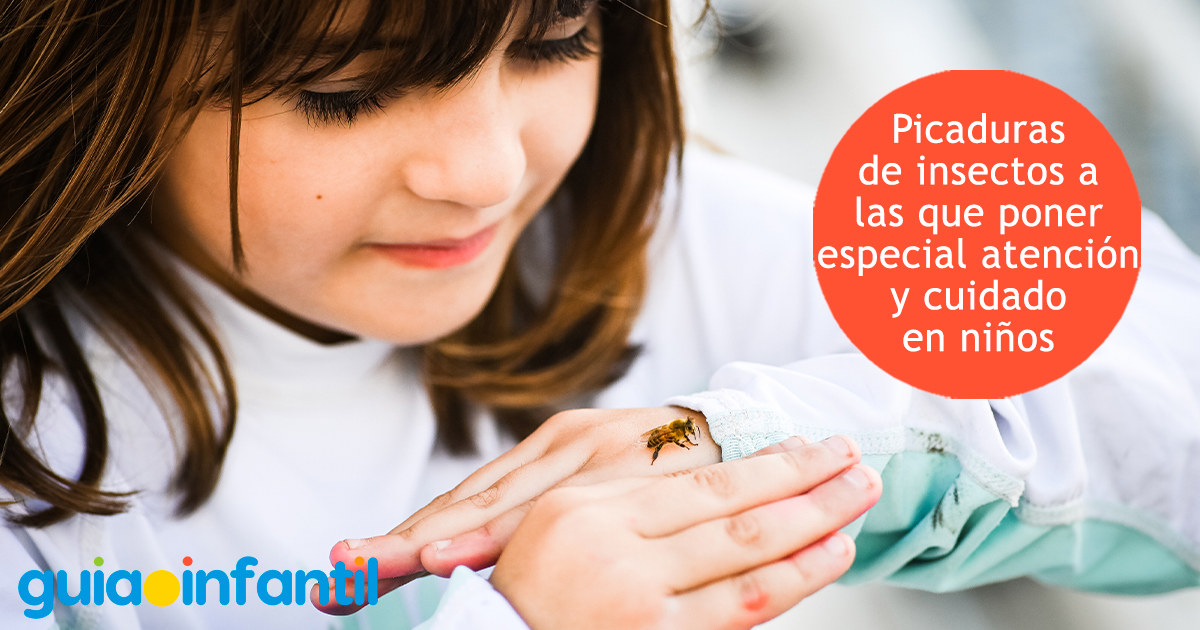 Atención a las picaduras de los niños