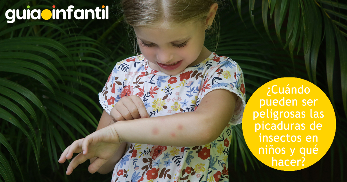 Peligro de las picaduras de insectos en niños