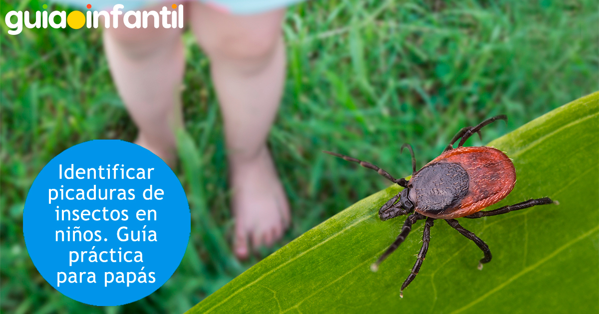 Guía de picaduras de insectos en niños