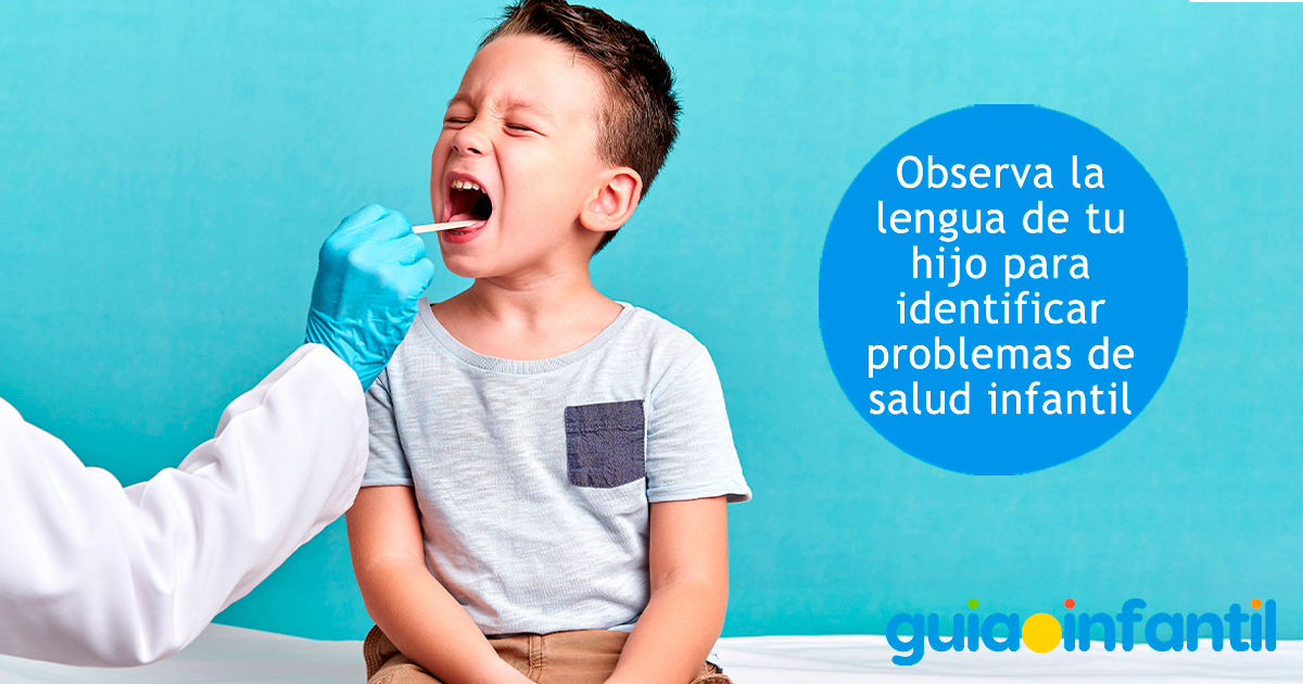 Problemas de salud por la lengua de los niños