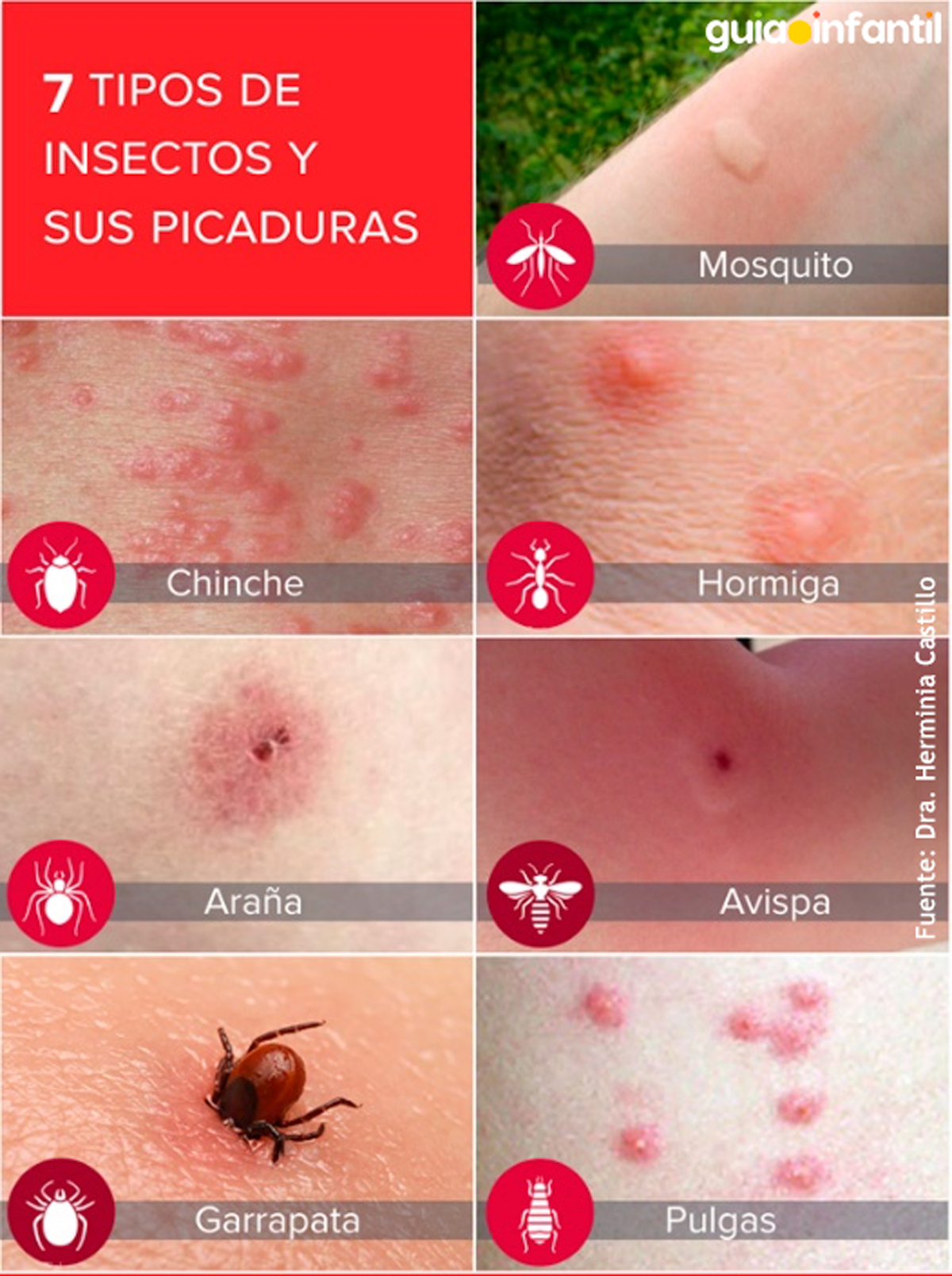 Guía de picaduras de insectos para padres