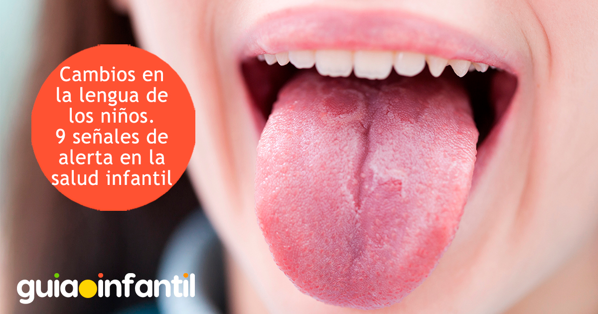 Señales de alerta en la lengua de los niños